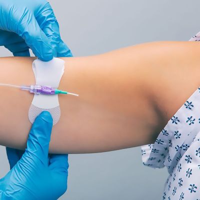 Grip-Lok Catheter / Line Securement Device - 100 / Case